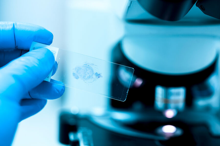 Molecular “guards” discovered in cancer cells