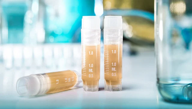 Is there Newcastle disease infection in Azerbaijan?