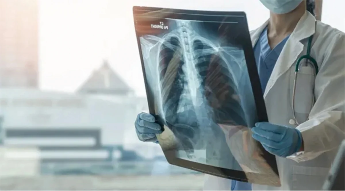 The number of children infected with tuberculosis in Azerbaijan last year has been announced