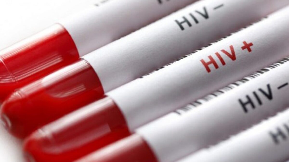 Official number of people living with HIV in Azerbaijan announced