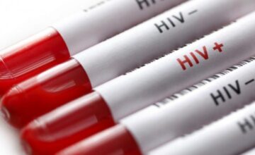 Official number of people living with HIV in Azerbaijan announced