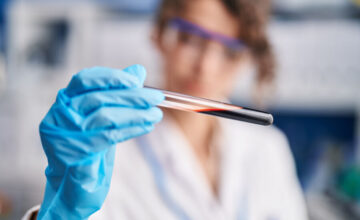 Obstacle to early diagnosis of Alzheimer’s removed