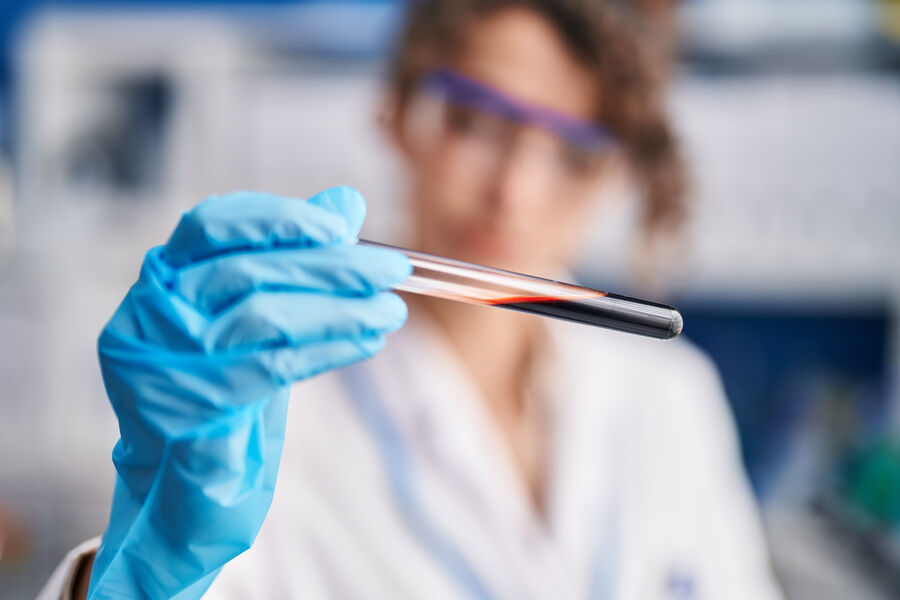 Obstacle to early diagnosis of Alzheimer’s removed