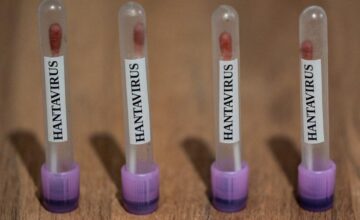 ABC: US monitors hantavirus cases with ‘Level 3 Emergency’ code