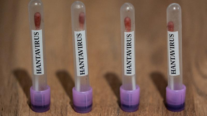ABC: US monitors hantavirus cases with ‘Level 3 Emergency’ code
