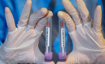 Could Hantavirus turn into a new pandemic?