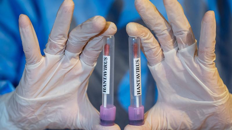 Could Hantavirus turn into a new pandemic?
