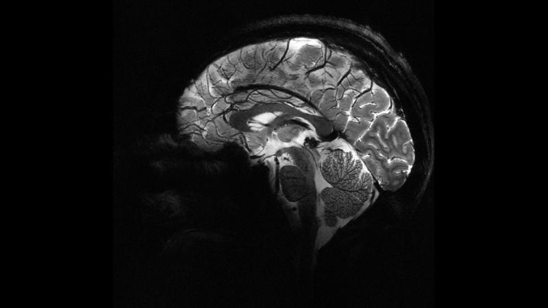 Scientists have created artificial nerve cells that can communicate with the brain