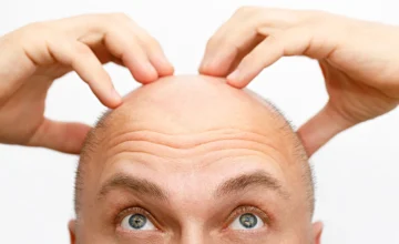 Ancient Chinese plant may be the cure for baldness