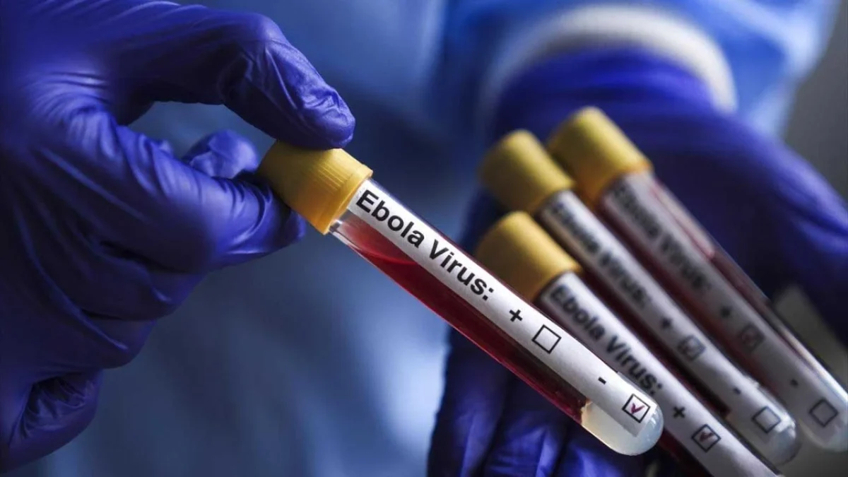 Deadly Ebola virus warning increases! Death toll exceeds 100!