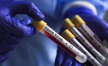 Deadly Ebola virus warning increases! Death toll exceeds 100!