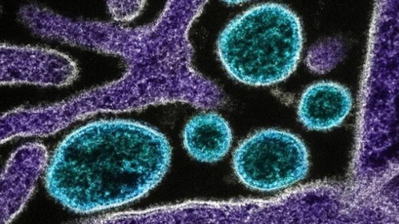 Artificial intelligence used to create new viruses
