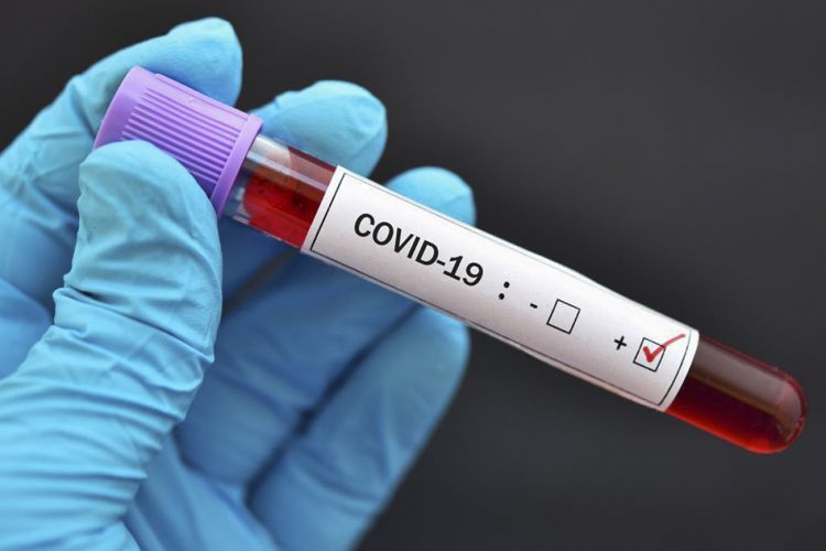 Are there any coronavirus cases in Azerbaijan? – Ministry responded