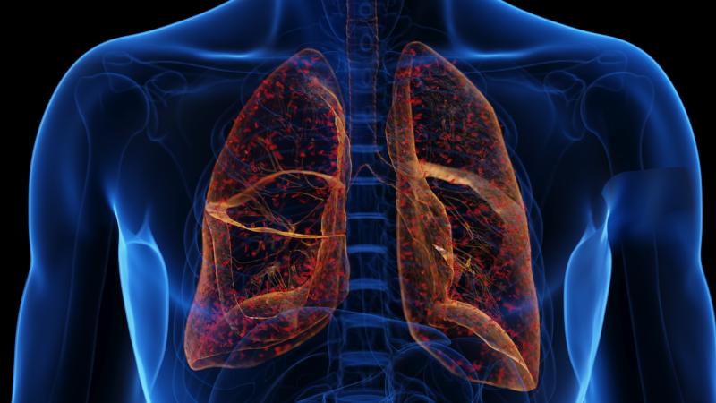 What is pneumonic plague and how dangerous is it?