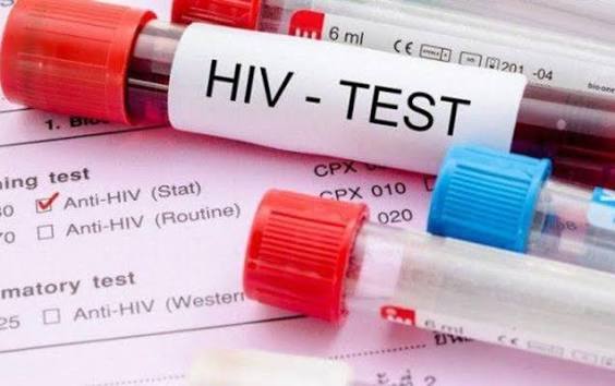 Number of people living with HIV in Azerbaijan